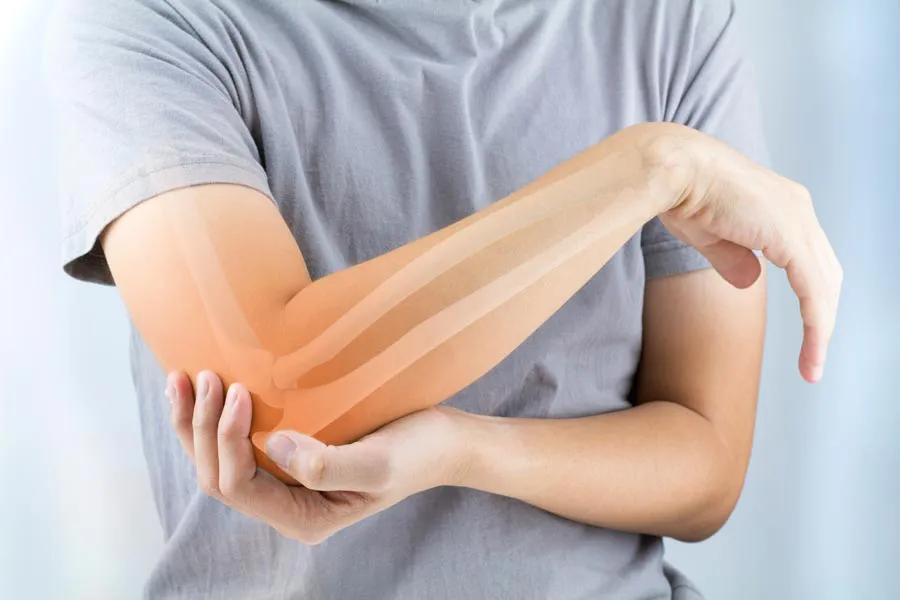 A close-up of a woman holding her elbow with an illustration of the bones and joint experiencing pain from osteoporosis. Get osteoporosis treatment from Dr. Bahar Amin in North York.