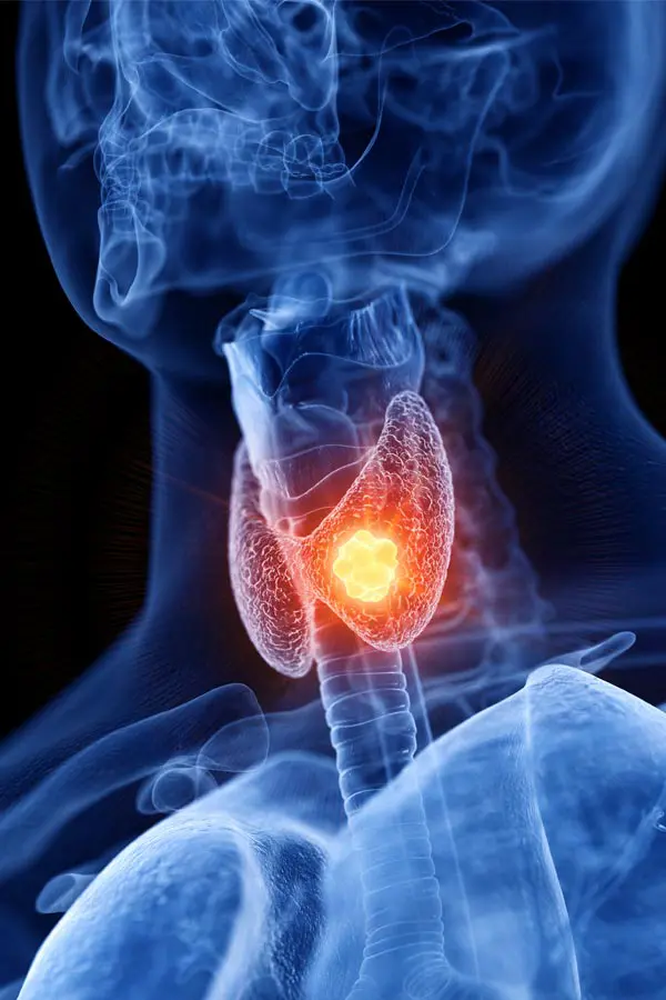 A 3D illustration of an x-ray of a human neck, highlighting the thyroid. Get help with thyroid imbalance from Dr. Bahar Amin in North York.